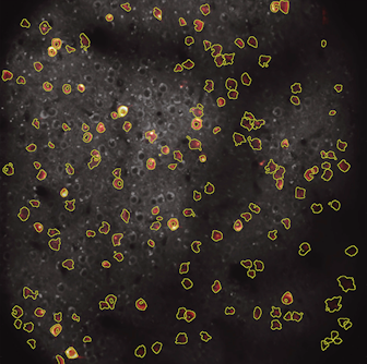 Automatic detection of neurons and neuronal processes contained in the data streams generated by brains of test subjects. Here, the pink and yellow objects are active neurons or neuronal processes detected in the brain of a mouse engaged in a behavioral task
